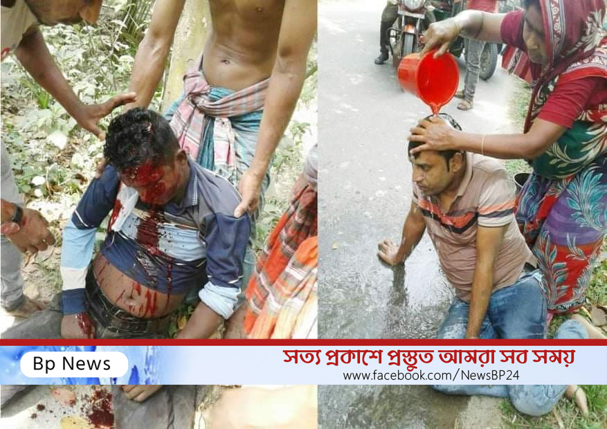 মটরসাইকেলের মুখোমুখি সংঘর্ষে নিহত এক